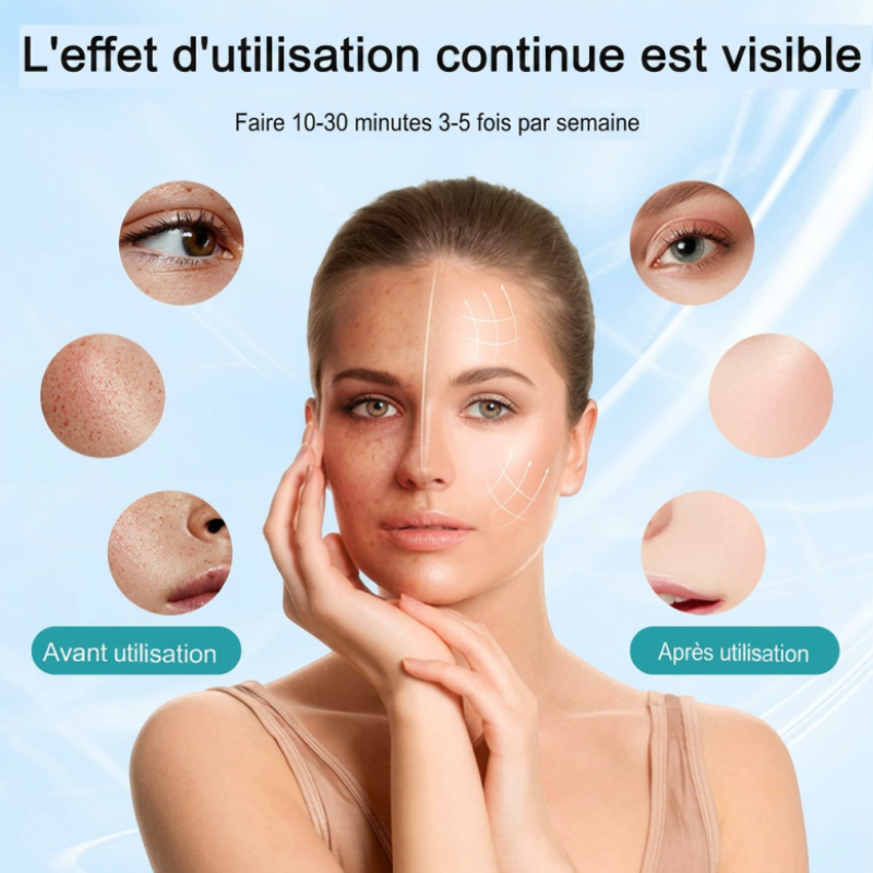 Masque LED Thérapie Intense – Image 9