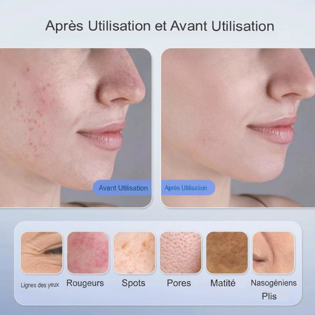Masque Infrarouge Sans Fil – Image 4